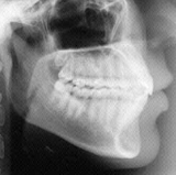Radiologia Odontológica em João Pessoa